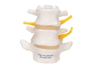 C – Compression Pinch