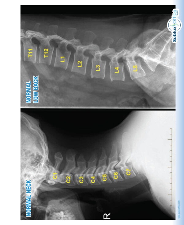 EDUCATION-SDR Normal X-Rays